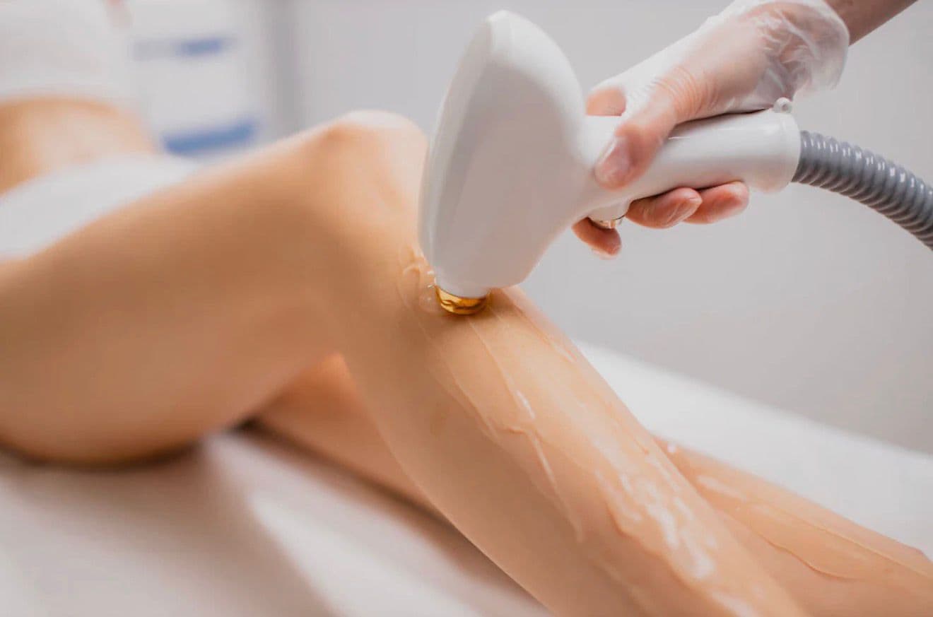 Épilation Laser