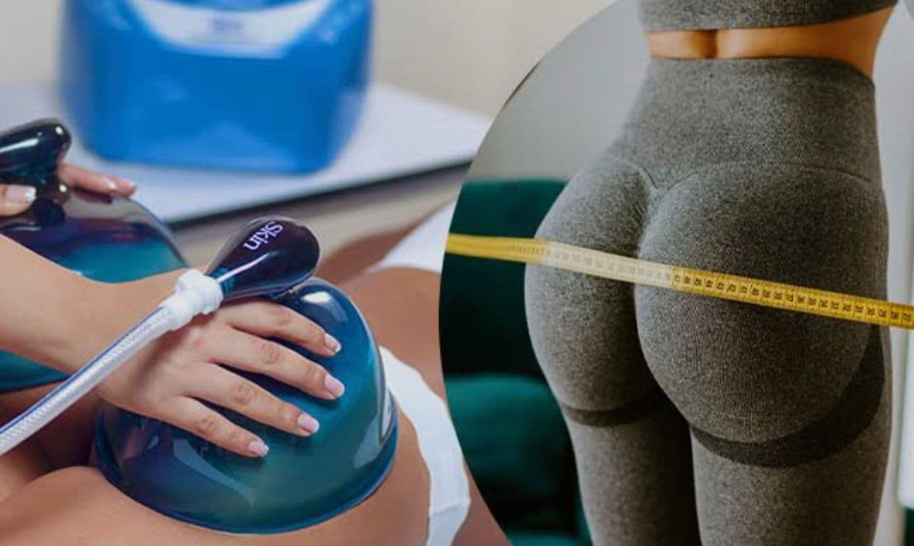 Traitement Colombien Fessier Vacuum Therapy